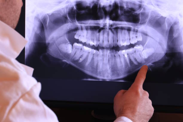 Best Emergency Dental Surgery in Annapolis, MD
