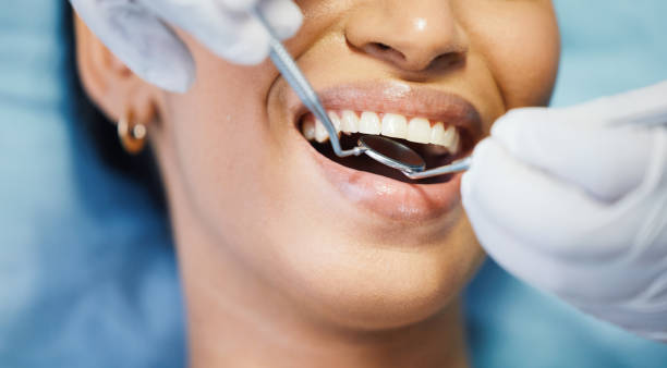 Best Emergency Broken Tooth Repair in Annapolis, MD